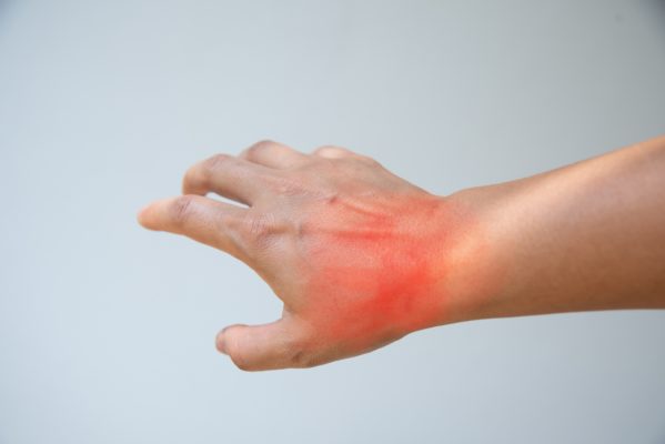 Ways to Fight Inflammation Medication-Free Pain Relief Contact Us
