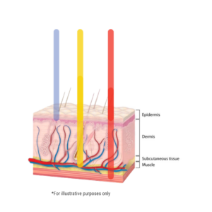 LED Therapy | UltraPain Products